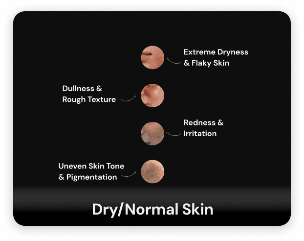 Woman with dry skin showing various skin concerns